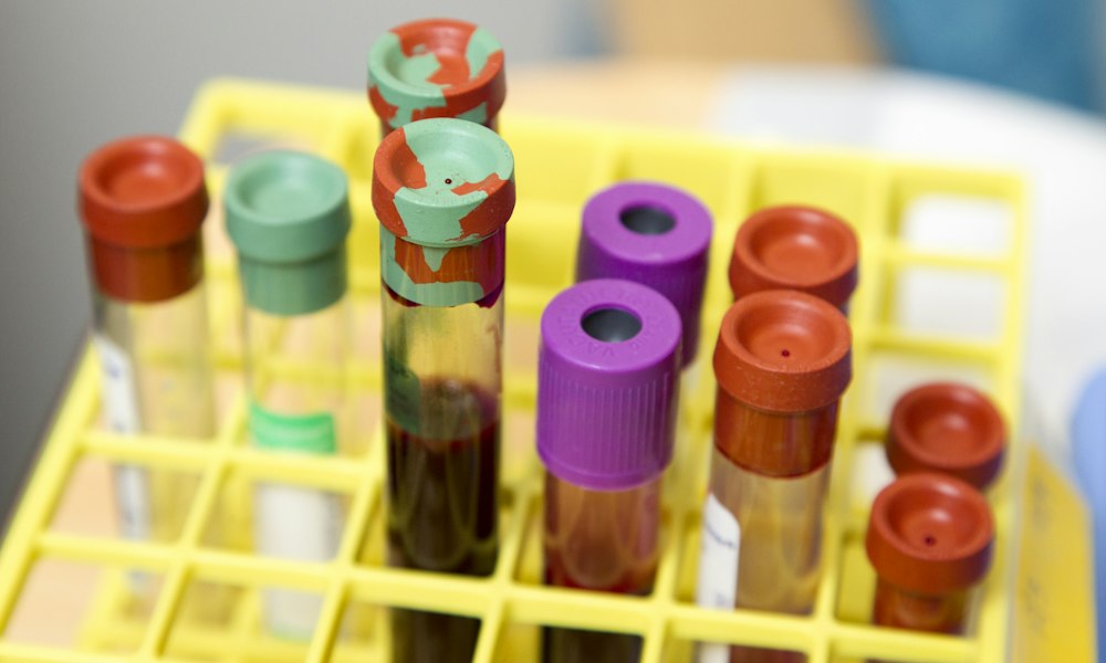 Biodisponibilidad del acetato de metenolona