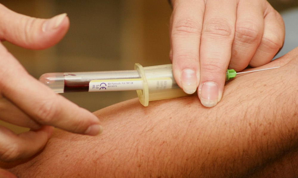 Finasterida: mitos y evidencia